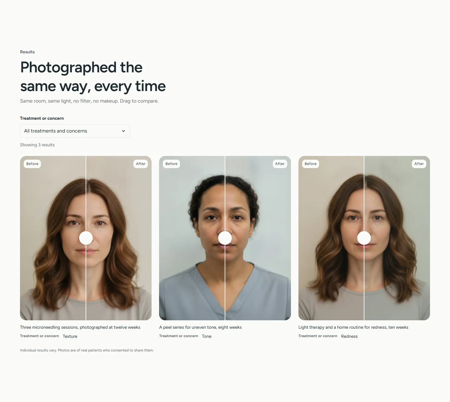 Before and after pairs with a filter on the Clinic preset.